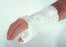Alimed Wrist / Hand / Thumb Splint Plasticast Polyethylene / Foam / Stockinette Right Hand White Small - 510272/NA/RS