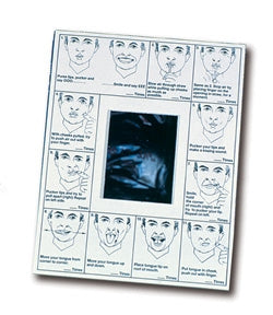 Alimed Oral Images Oral Image with Mirror 8-1/2 X 11 Inch Paper - 80610