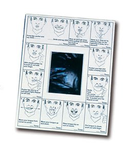 Oral Images - Mouth Exercise Chart Oral Image with Mirror 8-1/2 X 11 Inch Paper - 80610