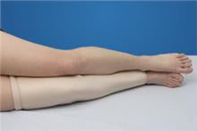 Alimed DermaSaver Protective Leg Tube X-Small - 66417/NA/NA/XS