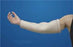 DermaSaver - Arm Tube X-Small - 52387/NA/NA/XS