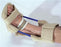 AliMed - Ankle Brace Alimed Medium Turnbuckle Male 6 to 9 / Female 8 to 11 Left or Right Foot - 66426/NA/NA/MD