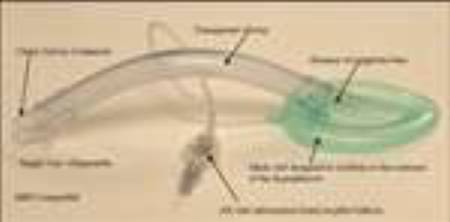 Ambu AuraOnce Laryngeal Mask Adult User Size 4 Yellow PP / PVC / Silicone Sterile Disposable - 321400000U