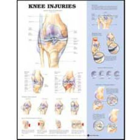Anatomical Chart Company Anatomical Chart Knee 20 X 26 Inch Styrene Plastic Grommets - 9781587796968