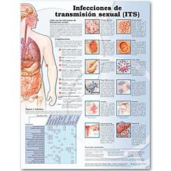 Anatomical Chart Company Anatomical Chart Sexually Transmitted Infections (Spanish) 20 X 26 Inch Plastic Wall Mount Laminated - 9780781773447