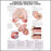 Anatomical Chart Company - Anatomical Chart Chronic Obstructive Pulmonary Disease 20 X 26 Inch Plastic Wall Mount Laminated - 9780781782371