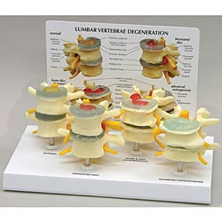 Anatomical Chart Company Vertebrae Set Model - G176