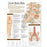 Anatomical Chart Company - Anatomical Chart Understanding Low Back Pain 20 X 26 Inch Heavy Paper Grommets Laminated - 9780781782432