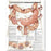 Anatomical Chart Company Anatomical Chart Understanding Colorectal Cancer 20 X 26 Inch Heavy Paper Grommets Laminated - 9780781773348
