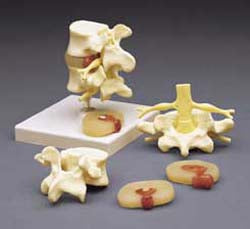 Anatomical Chart Company Lumbar Vertebrae Teaching Model - A76