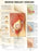 Anatomical Chart Company Anatomical Chart Benign Breast Disease 20 X 26 Inch Heavy Paper Grommets Laminated - 9781587796746