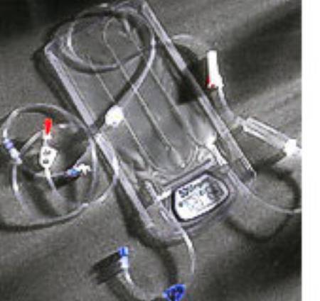 3M Ranger Fluid Warming Set 9,000 mL / Hr Drip Rate 30 Inch Tubing 1-Port - 24250