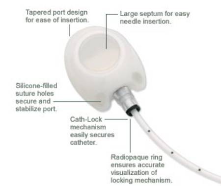 Bard X-Port Isp MRI Implantable Port 9.6 Fr. Single Lumen - 607555
