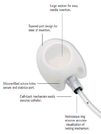 X-Port Isp - Implantable Port - 7757540