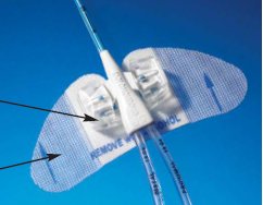Bard StatLock PICC Plus Central Venous Catheter Stabilization Device Statlock PICC Plus - VCDC