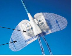 Statlock - Catheter / Line Securement Device - VFS