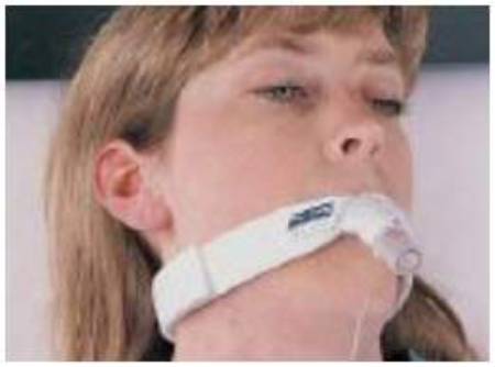 Bird & Cronin Endo-MATE Endotracheal Tube Holder - 8148115