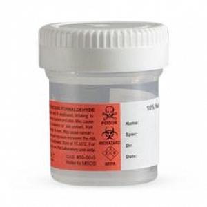 Cardinal SP Prefilled Formalin Container Polypropylene Screw Cap 7.5 mL Fill in 15 mL (0.5 oz.) NonSterile - C4320-7.5B