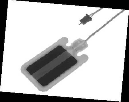 Conmed ThermoGard Plus ABC Split Grounding Pad Pediatric / Pre-attached 10 Foot Cable / Single Use - 7-383