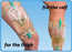 Core Products NelMed Urinary Bag Support Kit Two 2 Inch W Lined Elastic Bands - NEL-1360