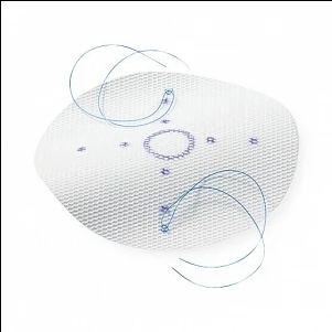Covidien Parietene Ventral Hernia Repair Patch Partially Absorbable Polypropylene 15 X 10 cm Rectangle Style - PPDS1510