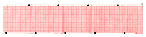 Zoll - Diagnostic Recording Paper Thermal Paper 90 mm X 59 Foot Z-Fold Red Grid - 7G32015945