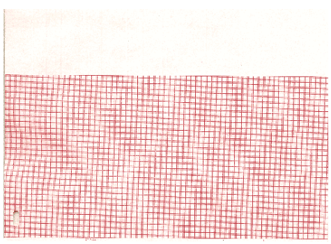 ECG Recording Paper
