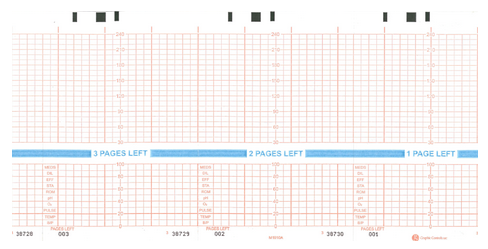  Fetal Monitor Recording Paper
