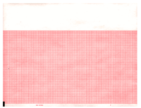 ECG Recording Paper
