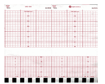 Fetal Monitor Recording Paper