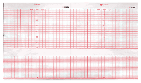 Fetal Monitor Recording Paper