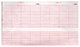 Fetal Monitor Recording Paper
