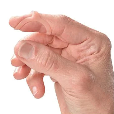 Oval-8 - Finger Splint Kit Adult Size 2 to 15 Pull-On Left or Right Hand Tan - P1008-K
