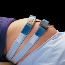 DeRoyal - Fetal Monitor Strap Abdominal, Elastic, with Button Tab - M1140