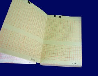 Electro Medical Recording Chart Paper Thermal Z-Fold Orange Grid - CM1910A