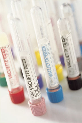 Greiner Bio-One Vacuette Z Serum Clot Activator Venous Blood Collection Tube Serum Tube Clot Activator Additive 13 X 75 mm 2 mL Red / White Ring Pull Cap Polyethylene Terephthalate (PET) Tube - 454236
