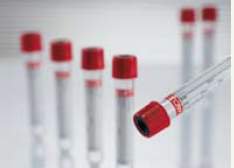 Greiner Bio-One Vacuette Z Serum Clot Activator Venous Blood Collection Tube Serum Tube Clot Activator Additive 16 X 100 mm 9 mL Red / Black Ring Pull Cap Polyethylene Terephthalate (PET) Tube - 455092