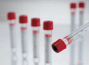 Greiner Bio-One Vacuette Z Serum Clot Activator Venous Blood Collection Tube Serum Tube Clot Activator Additive 13 X 100 mm 6 mL Red / Black Ring Pull Cap Polyethylene Terephthalate (PET) Tube - 456089