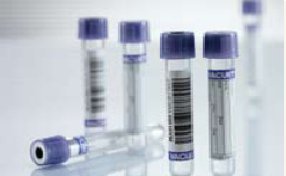 Greiner Bio-One Vacuette Venous Blood Collection Tube Whole Blood Tube K3 EDTA Additive 13 X 75 mm 4 mL Lavender / Black Ring Pull Cap Polyethylene Terephthalate (PET) Tube - 454021