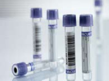 Vacuette - VACUETTE Venous Blood Collection Tube K3 EDTA Additive 16 X 100 mm 9 mL Lavender / Black Ring Pull Cap Polyethylene Terephthalate (PET) Tube - 455036