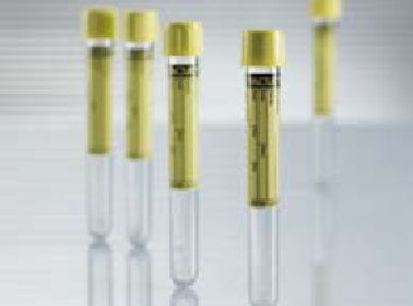 Greiner Bio-One Vacuette Urinalysis Tube Conical Bottom Plain 16 X 100 mm 9.5 mL Yellow Pull Cap Polyethylene Terephthalate (PET) Tube - 455028