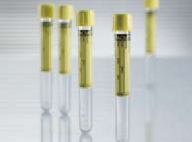 Vacuette - VACUETTE Urinalysis Tube Conical Bottom Plain 16 X 100 mm 9.5 mL Yellow Pull Cap Polyethylene Terephthalate (PET) Tube - 455028