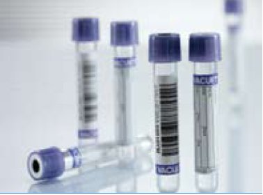 Greiner Bio-One Vacuette Venous Blood Collection Tube Serum Tube K2 EDTA Additive 13 X 75 mm 3 mL Lavender / Black Ring Pull Cap Polyethylene Terephthalate (PET) Tube - 454246