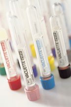Vacuette - VACUETTE Venous Blood Collection Tube K3 EDTA Additive 13 X 100 mm 6 mL Lavender / Black Ring Pull Cap Polyethylene Terephthalate (PET) Tube - 456003