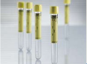 Greiner Bio-One Vacuette Urinalysis Tube Round Bottom Plain 13 X 100 mm 6.5 mL Yellow Screw Cap Polyethylene Terephthalate (PET) Tube - 456007