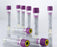 Greiner Bio-One Vacuette Venous Blood Collection Tube Analyte Determination Sodium Heparin Additive 13 X 100 mm 6 mL Royal Blue / Black Ring Pull Cap Polyethylene Terephthalate (PET) Tube - 456275