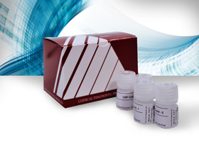 Microalbumin Control Set