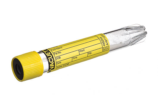 Urinalysis Tube