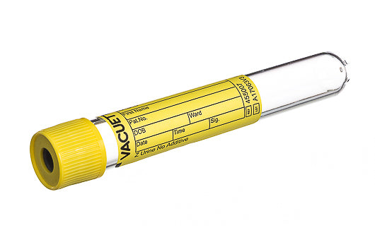 Urinalysis Tube