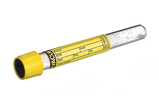 Urinalysis Tube